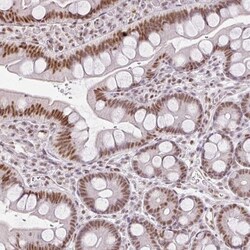 FAM32A Antibody, Novus Biologicals 25 &mu;L, Unlabeled:Antibodies, Polyclonal