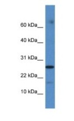 FAM36A Antibody, Novus Biologicals:Antibodies:Primary Antibodies
