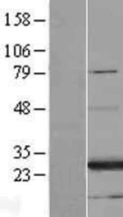 Novus Biologicals™ FAM3A Overexpression Lysate