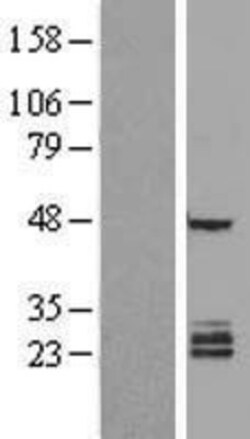 Novus Biologicals&trade;&nbsp;FAM3B Overexpression Lysate