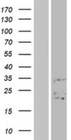 Novus Biologicals&trade;&nbsp;FAM3B Overexpression Lysate