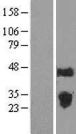 Novus Biologicals&trade;&nbsp;FAM3C Overexpression Lysate