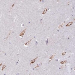 FAM3C Antibody, Novus Biologicals 0.1mL; Unlabeled:Antibodies, Polyclonal