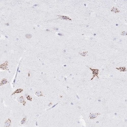 FAM3C Antibody, Novus Biologicals:Antibodies:Primary Antibodies