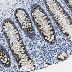FAM3D Antibody, Novus Biologicals 0.1mL; Unlabeled:Antibodies, Polyclonal