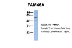 FAM46A Antibody, Novus Biologicals 100&mu;L; Unlabeled:Antibodies, Polyclonal