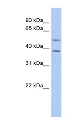 FAM46A Antibody, Novus Biologicals 100&mu;L; Unlabeled:Antibodies, Polyclonal
