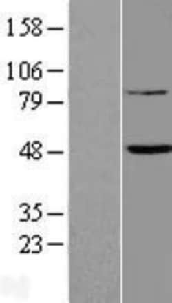 Novus Biologicals™ FAM46B Overexpression Lysate