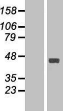 Novus Biologicals&trade;&nbsp;FAM46C Overexpression Lysate