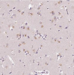 FAM46C Antibody, Novus Biologicals 25ul | Buy Online | Novus Biologicals | Fisher Scientific