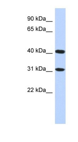 FAM46D Antibody, Novus Biologicals 100&mu;L; Unlabeled:Antibodies, Polyclonal