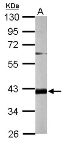 FAM46D Antibody, Novus Biologicals 0.1mL; Unlabeled:Antibodies, Polyclonal