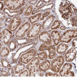 FAM47E Antibody, Novus Biologicals 25 &mu;L | Buy Online | Novus Biologicals | Fisher Scientific