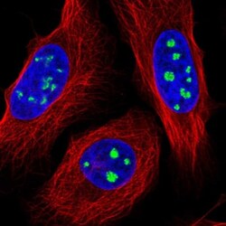 FAM48A Antibody, Novus Biologicals 0.1mL; Unlabeled:Antibodies, Polyclonal