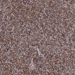 FAM48A Antibody, Novus Biologicals 0.1mL; Unlabeled:Antibodies, Polyclonal