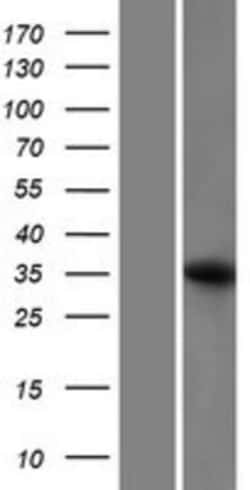 Novus Biologicals&trade;&nbsp;FAM49B Overexpression Lysate