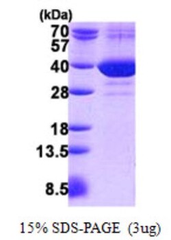 Novus Biologicals&trade;&nbsp;Recombinant Human FAM49B His Protein
