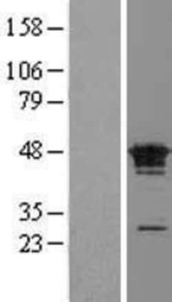 Novus Biologicals&trade;&nbsp;FAM50A Overexpression Lysate
