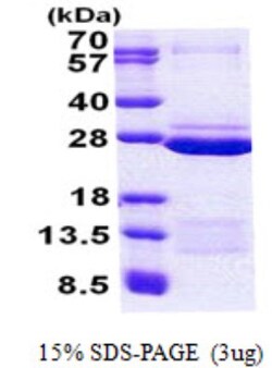Novus Biologicals&trade;&nbsp;Recombinant Human FAM50A His Protein