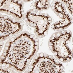 FAM50A Antibody, Novus Biologicals 0.1mL; Unlabeled:Antibodies, Polyclonal