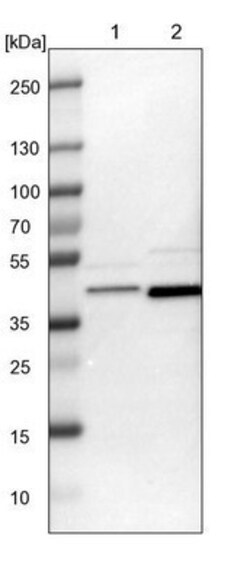 FAM50A Antibody, Novus Biologicals 0.1mL; Unlabeled:Antibodies, Polyclonal