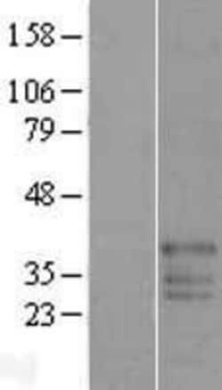 Novus Biologicals&trade;&nbsp;FAM50B Overexpression Lysate