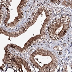 FAM53B Antibody, Novus Biologicals:Antibodies:Primary Antibodies