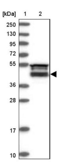 FAM53B Antibody, Novus Biologicals 25 &mu;L; Unlabeled:Antibodies, Polyclonal