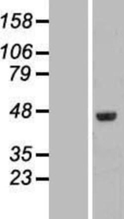 Novus Biologicals™ FAM53C Overexpression Lysate