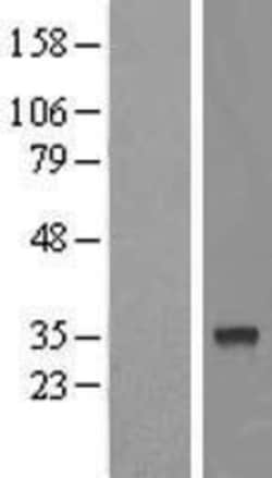 Novus Biologicals&trade;&nbsp;FAM54B Overexpression Lysate
