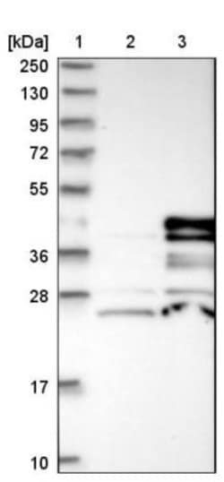 Carboxypeptidase A4/CPA4 Antibody, Novus Biologicals:Antibodies:Primary