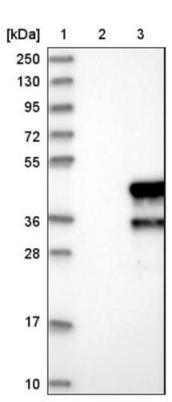 CYP24A1 Antibody, Novus Biologicals:Antibodies:Primary Antibodies