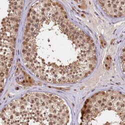 FAM55B Antibody, Novus Biologicals 0.1mL; Unlabeled:Antibodies, Polyclonal