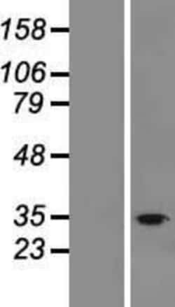 Novus Biologicals&trade;&nbsp;FAM57B Overexpression Lysate