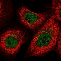 FAM58A Antibody, Novus Biologicals 25ul | Buy Online | Novus Biologicals | Fisher Scientific