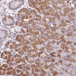 FAM58A Antibody, Novus Biologicals 25ul | Buy Online | Novus Biologicals | Fisher Scientific