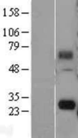 Novus Biologicals FAM60A Overexpression Lysate 0.1mg | Buy Online | Novus Biologicals&trade; | Fisher Scientific