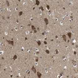 FAM69A Antibody, Novus Biologicals:Antibodies:Primary Antibodies