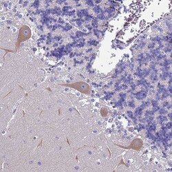 FAM69B Antibody, Novus Biologicals 25 &mu;L, Unlabeled:Antibodies, Polyclonal