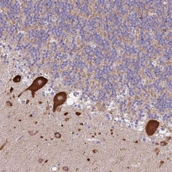 FAM69C Antibody, Novus Biologicals 25 &mu;L, Unlabeled:Antibodies, Polyclonal