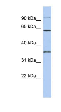 FAM71B Antibody, Novus Biologicals 100&mu;L; Unlabeled:Antibodies, Polyclonal