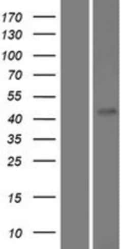 Novus Biologicals™ FAM71D Overexpression Lysate