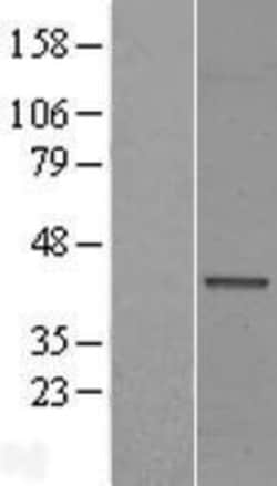 Novus Biologicals&trade;&nbsp;FAM71F1 Overexpression Lysate