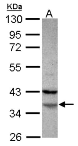 FAM76A Antibody, Novus Biologicals 0.1mL; Unlabeled:Antibodies, Polyclonal