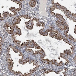 FAM78A Antibody, Novus Biologicals 25 &mu;L; Unlabeled:Antibodies, Polyclonal