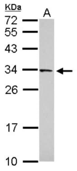 FAM78B Antibody, Novus Biologicals 0.1mL; Unlabeled:Antibodies, Polyclonal