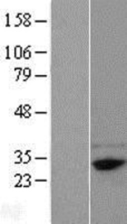 Novus Biologicals FAM78B Overexpression Lysate 0.1mg | Buy Online | Novus Biologicals&trade; | Fisher Scientific