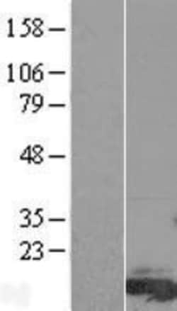 Novus Biologicals™ FAM81A Overexpression Lysate