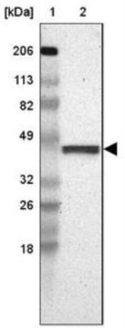 FAM81A Antibody, Novus Biologicals 25 &mu;L, Unlabeled:Antibodies, Polyclonal