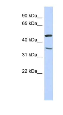 FAM81B Antibody, Novus Biologicals 100 &mu;L | Buy Online | Novus Biologicals | Fisher Scientific